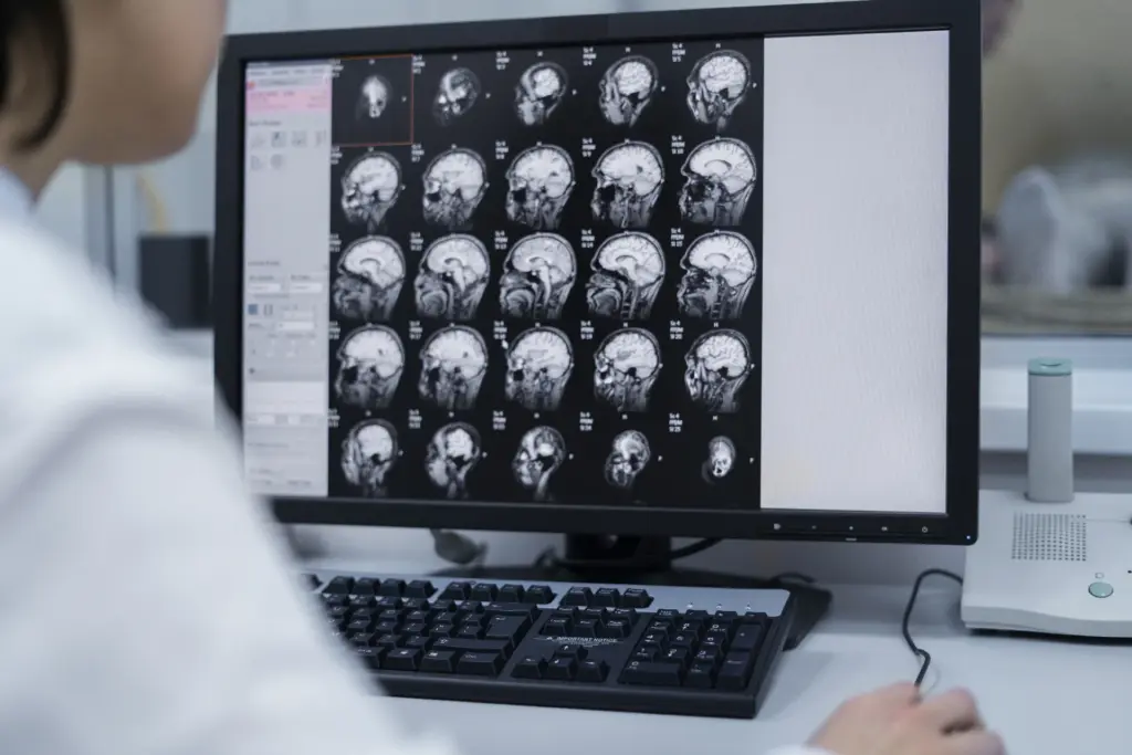 Neurorradiologia