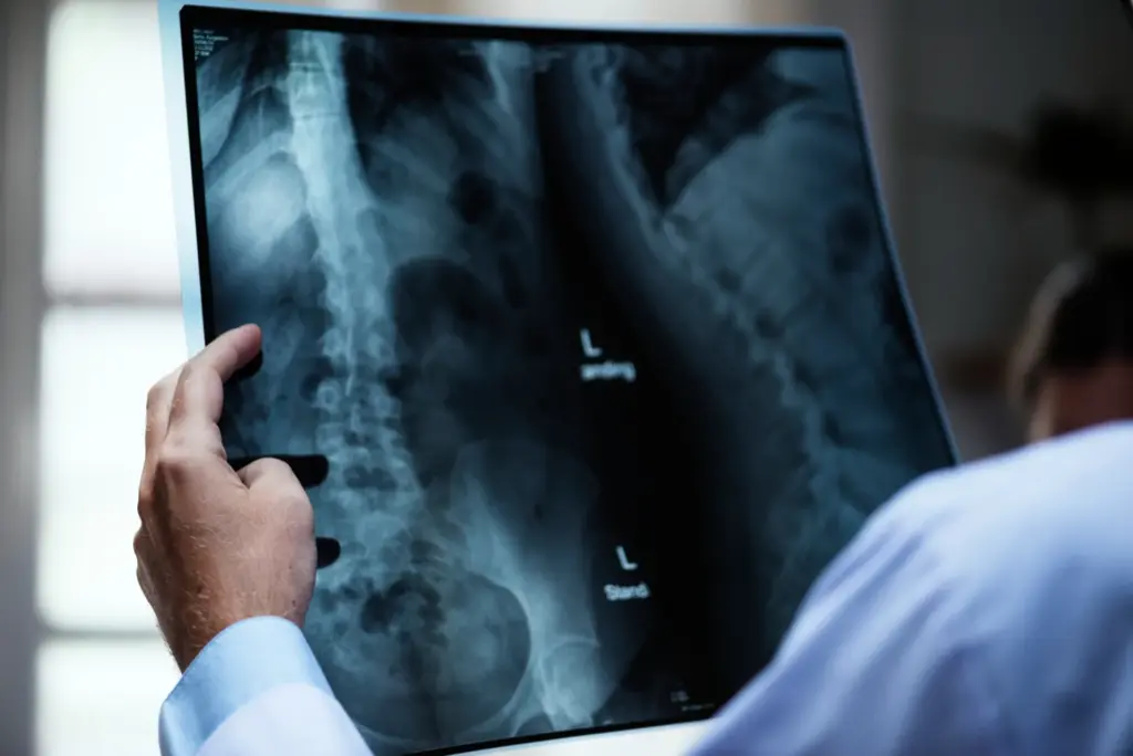 Raio-X (Radiologia)